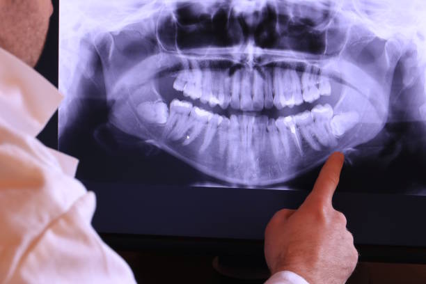 Best Emergency Root Canal Treatment in Tavares, FL